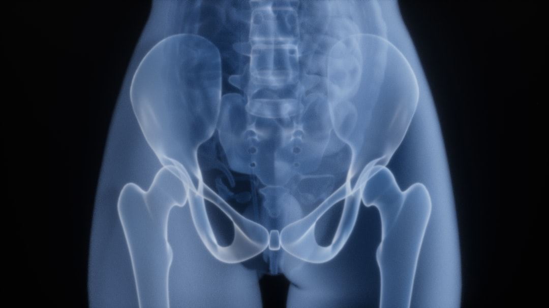 Navigating Treatment Decisions for Advanced Prostate Cancer: A Patient-Centered Approach