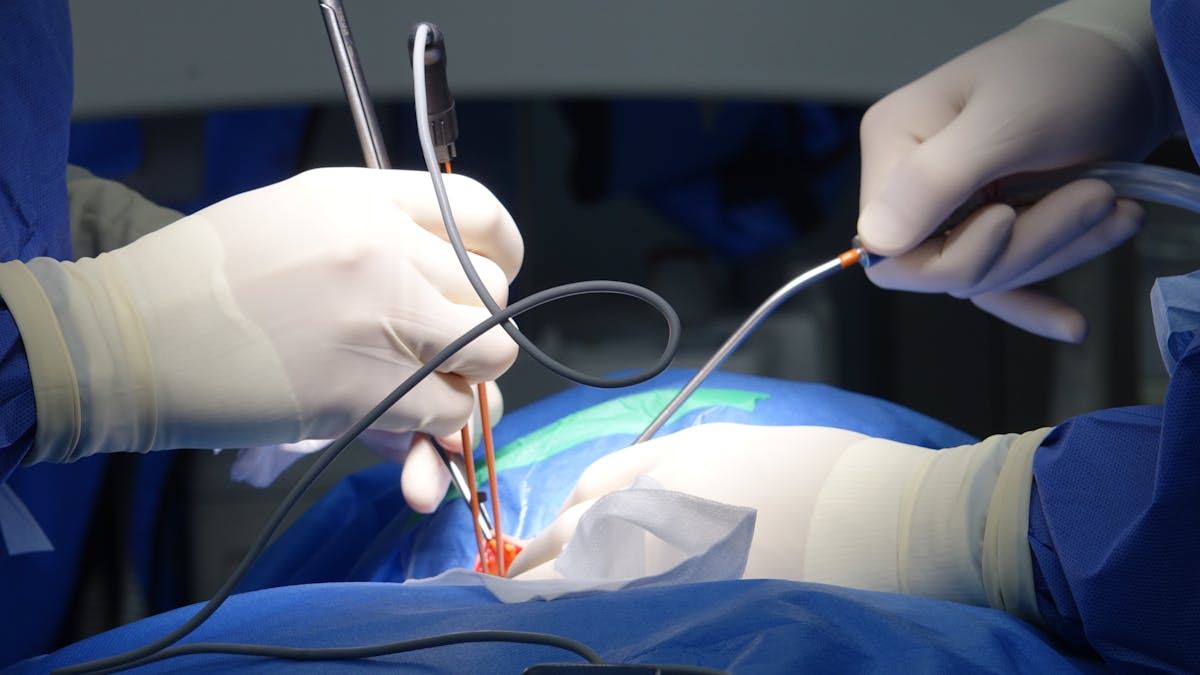 The Clinical Significance of Aortic Stenosis and Atrial Fibrillation in Cardiovascular Health