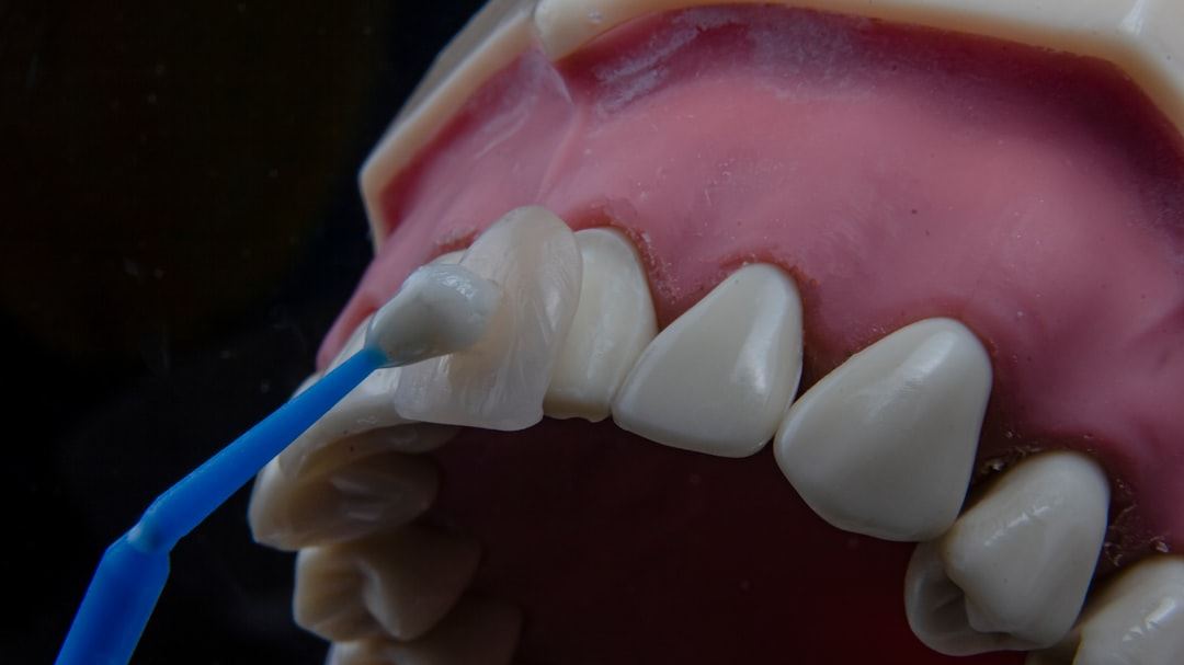 The Evolution and Future of Teeth Dental Implants: What You Need to Know