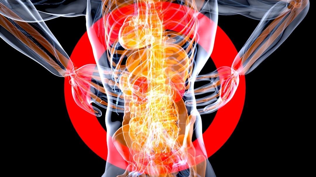Recognizing the Signs: Key Diverticulitis Symptoms Every Patient Should Know