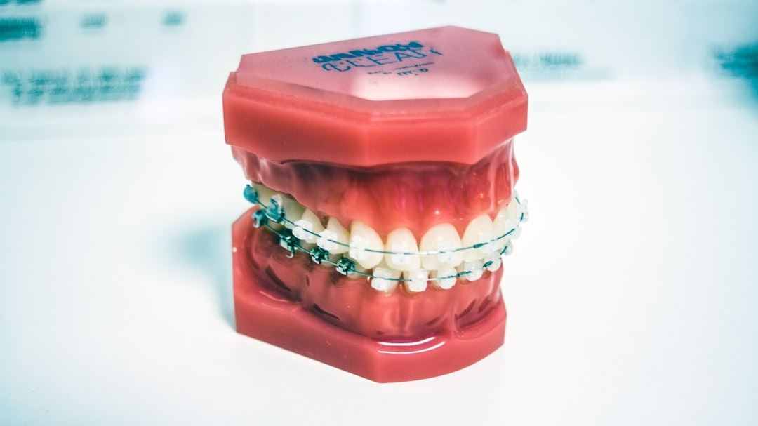 A Complete Breakdown: How Much Do Dental Implants Cost and What Are Your Investment Options in the United States?