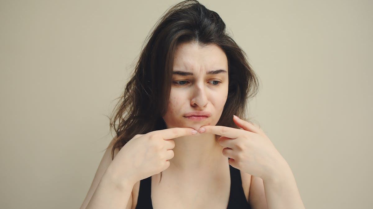 Innovative Approaches to Big Cystic Pimple Removal: What You Need to Know for Safe and Effective Treatment