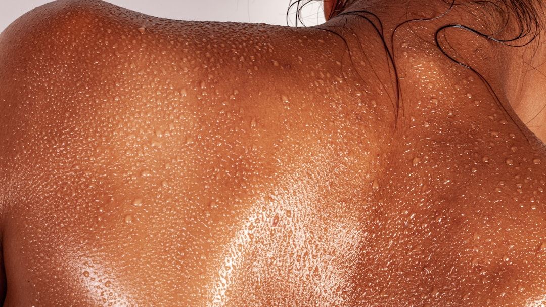 Mastering the Skin Rash Identifying Chart: From Symptoms to Diagnosis and Treatment