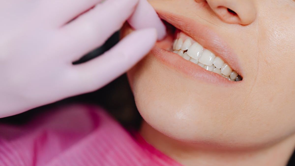 Breaking Down the Full Mouth Dental Implant Prices List in the US: What Patients Should Expect