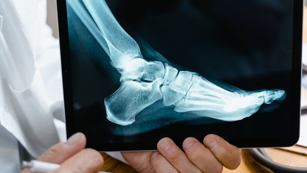 Why Specialized Spinal Cord Injury Attorneys Are Essential for Your Case Success
