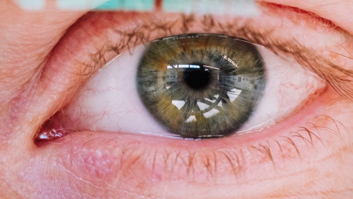 Does Psoriasis Look Like What You Think? A Deep Dive Into Visual Symptoms and Variations