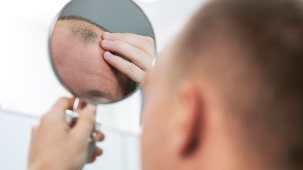 Innovative Hair Loss Solutions in the United States: From Traditional Methods to Cutting-Edge Technologies