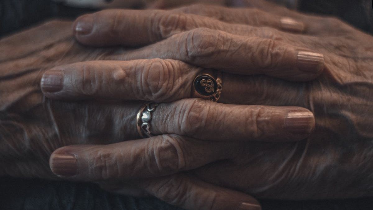 Spotting the Sign Symptoms Psoriatic Arthritis Early: What Every Patient Needs to Know