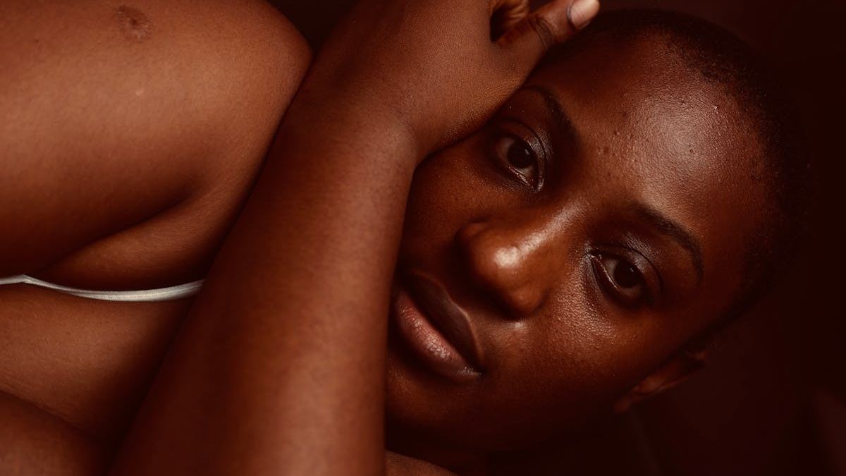 Mastering the Art of Identifying My Skin Rash: A Step-by-Step Approach for Effective Diagnosis
