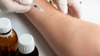 Unlocking New Horizons: Research atopic dermatitis itch relief with Innovative Approaches and Therapies