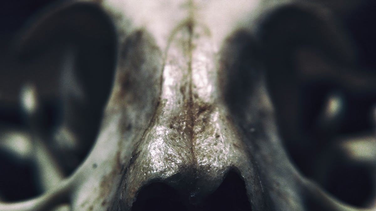 Deciphering Osteopenia: An Essential Explanation of Its Definition and Impact on Bone Wellness