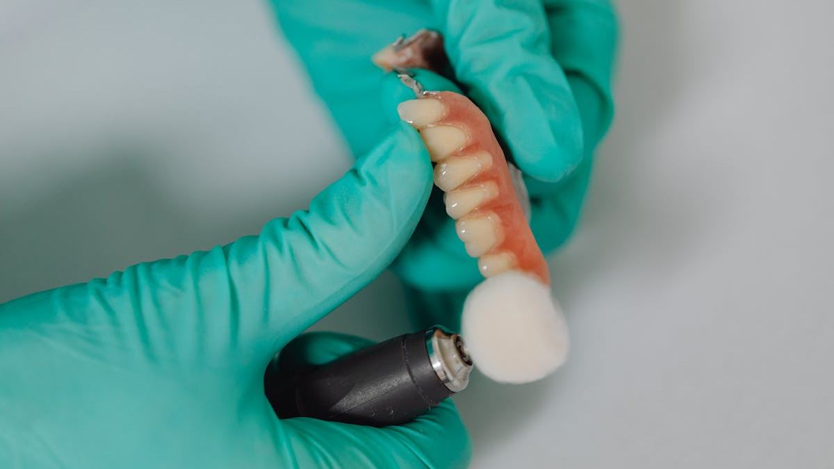 Mastering Dental Implant Financing: Strategies to Achieve Your Dream Smile in the USA