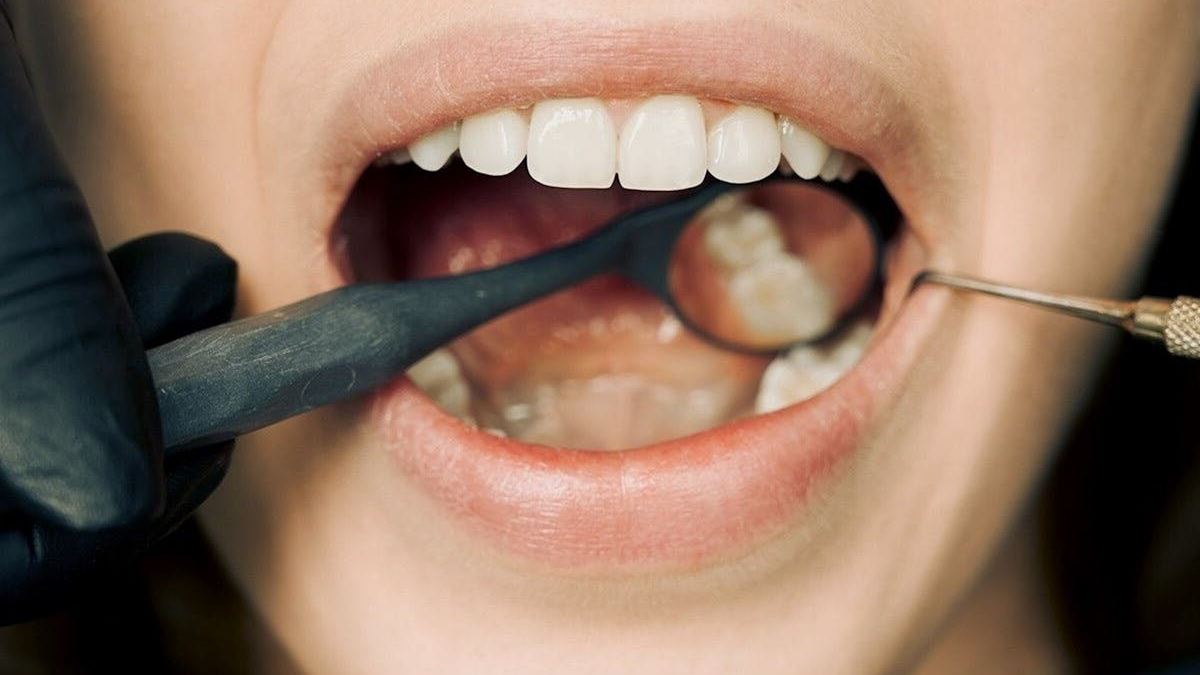 Your Local Guide to Finding a Reliable Dental Implant Dentist Nearby for a Smile Makeover
