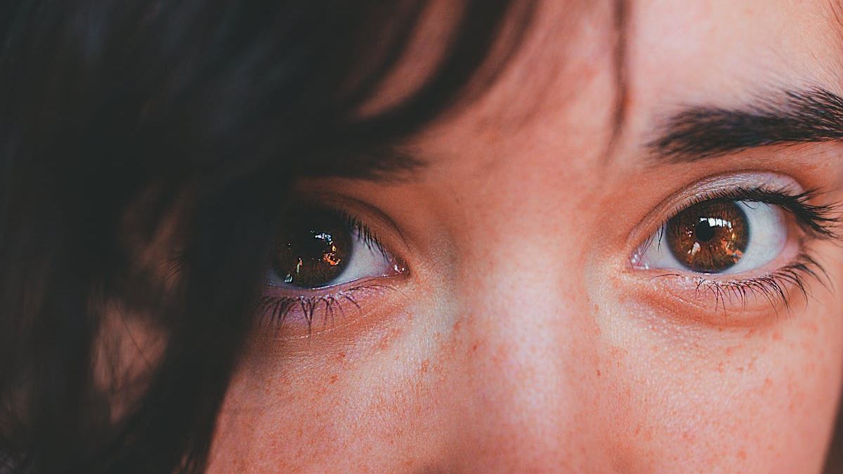 Does Purpura Look Like? A Medical Perspective on Identifying Skin Bleeding Disorders