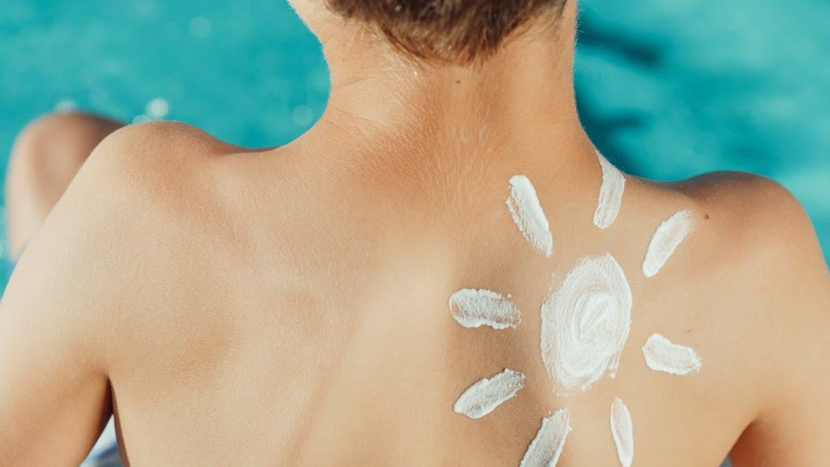The Role of Sun Protection in Preventing Melanoma: Expert Insights and Practical Tips