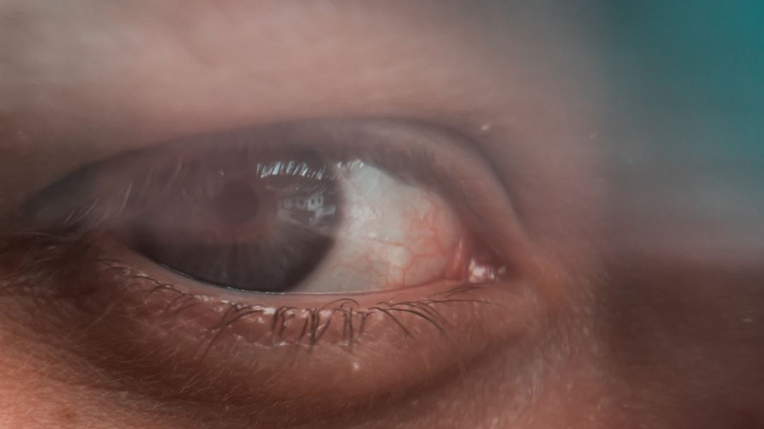 LASIK Eye Surgery: Pros, Cons, and What You Should Consider Before Making a Decision