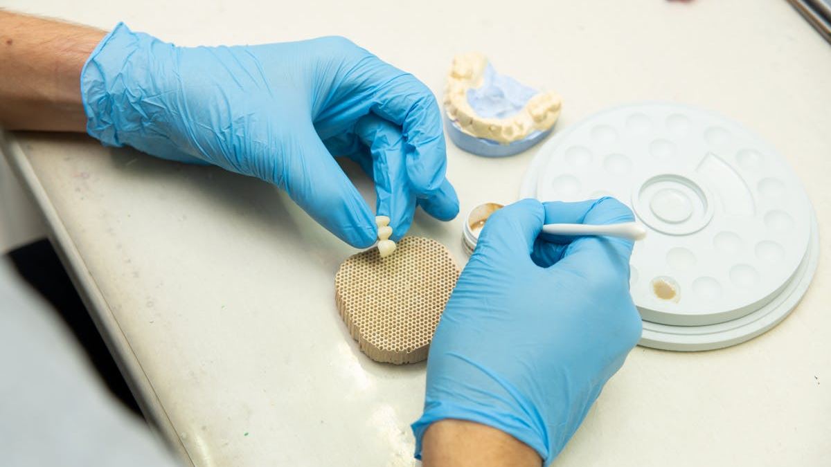 Maximizing Success with Immediate Dental Implants: Expert Tips and Patient Perspectives