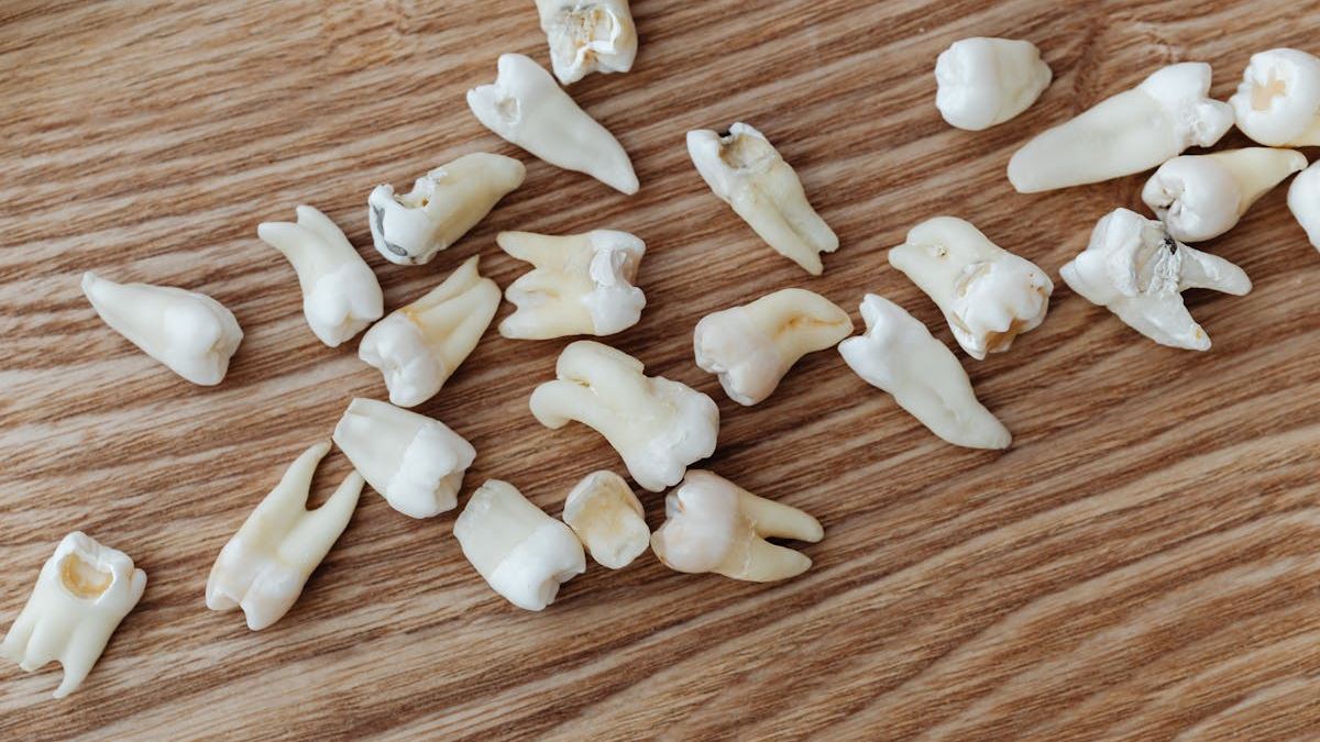 All NN4 Dental Implants in the United States: Providing Patients with Cutting-Edge Tooth Replacement Solutions
