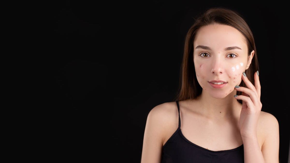 Effective Strategies for Massive Cystic Pimple Removal: A Complete Guide for Safe and Successful Results