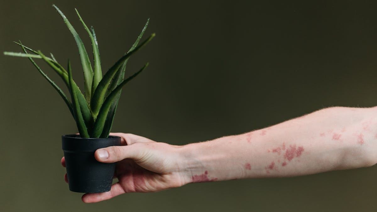 Identifying Different Types of Rashes: A Guide to Skin Reactions and Their Management